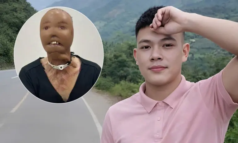 Tai nạn bất ngờ khiến cơ thể biến dạng, bạn xoay xở thế nào